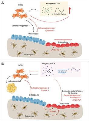 Distinct Glucocorticoid Receptor Actions in Bone Homeostasis and Bone Diseases